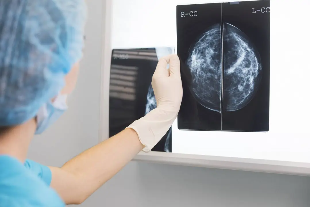 Unha sanitaria observa unha mamograf&iacute;a.