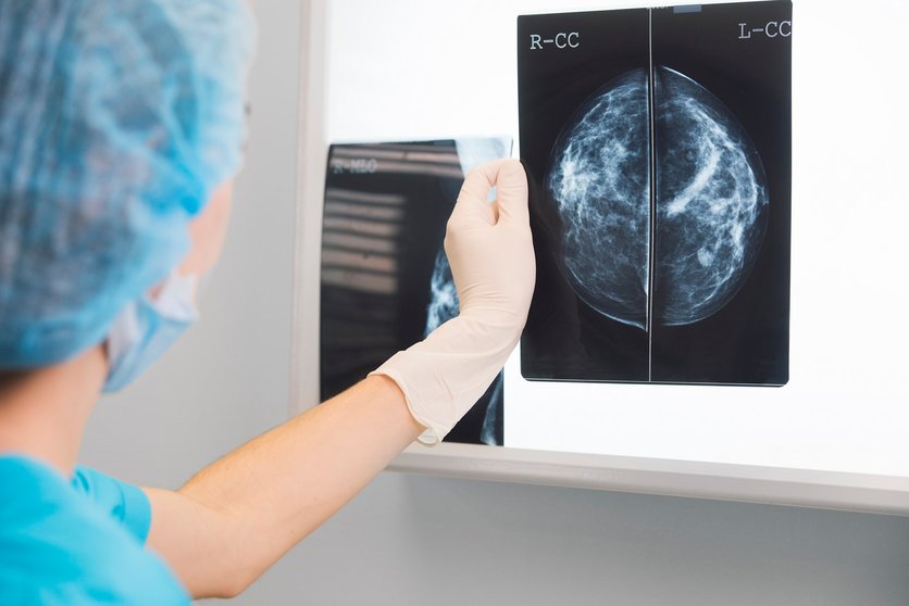 Unha sanitaria observa unha mamografía.