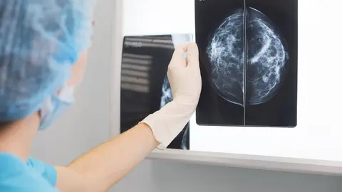 Unha sanitaria observa unha mamograf&iacute;a.