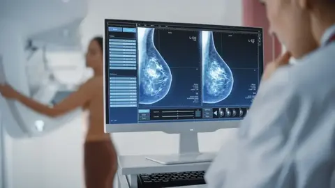 O Sergas facilita o desprazamento dende Xinzo a Ourense para a realizaci&oacute;n de mamografias.